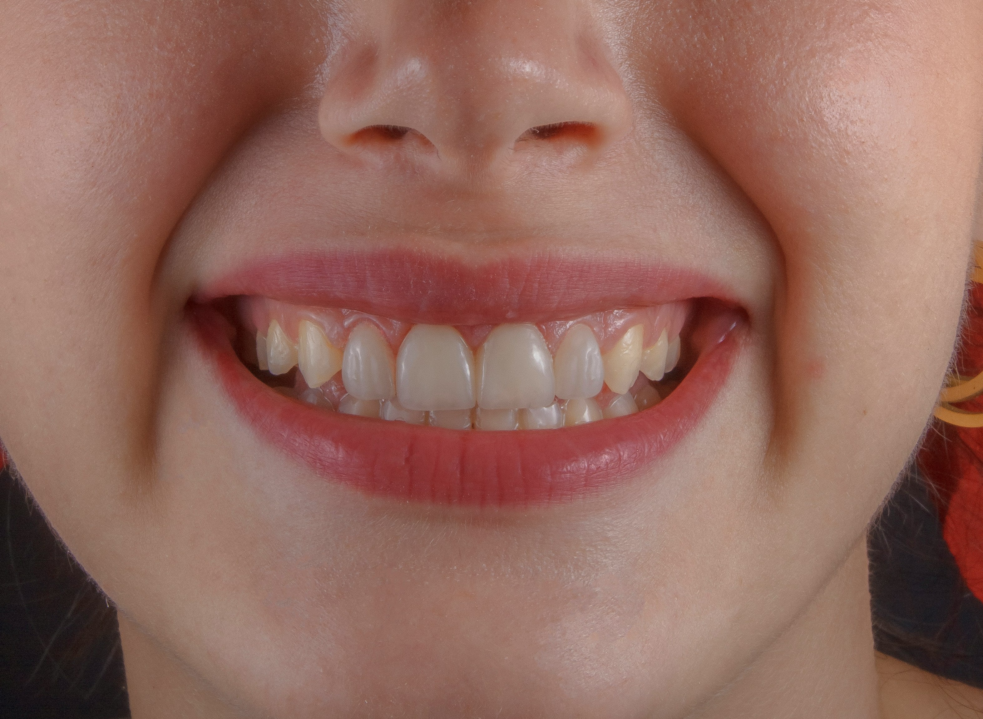Why natural oral care is the future of dental health